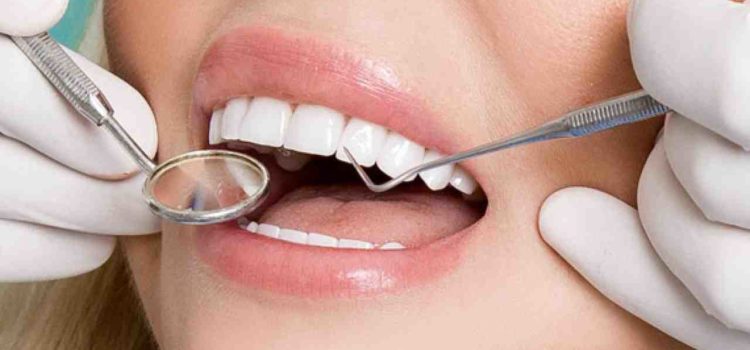Do-most-celebrities-have-veneers-2 Do-most-celebrities-have-veneers-2