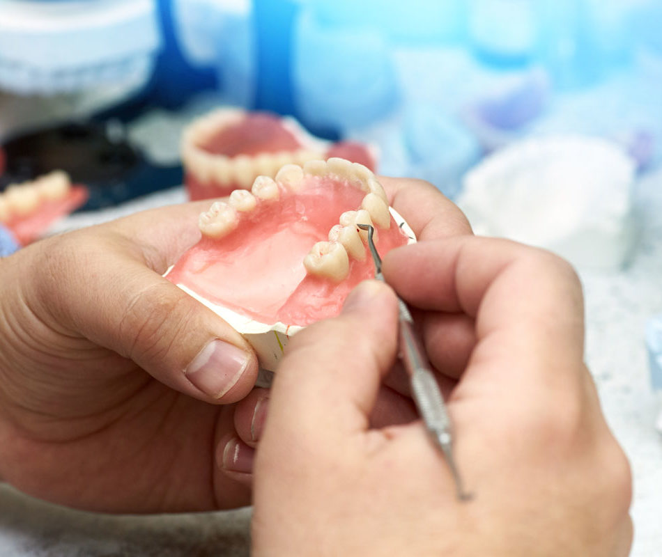agd-teeth-replacement agd-teeth-replacement